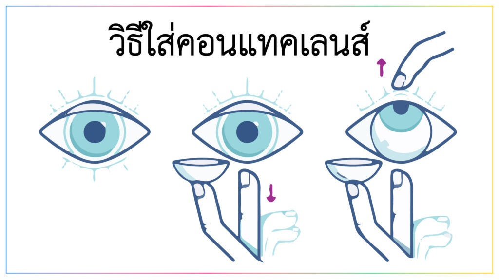 วิธีการใส่คอนแทคเลนส์