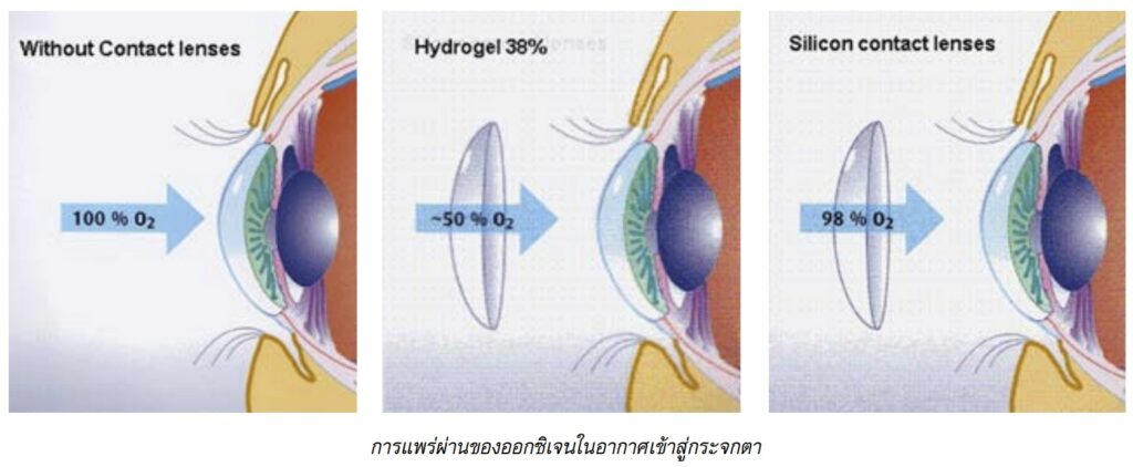 การแพร่ผ่านของออกซิเจนในอากาศเข้าสู่กระจกตา